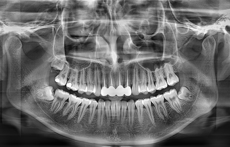 Отображение панорамных изображений