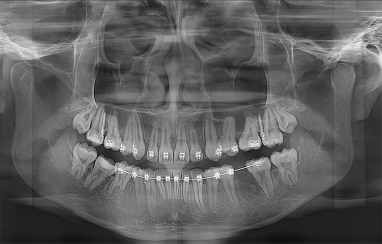 Отображение панорамных изображений